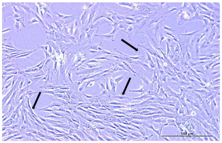 Light micrograph of cultured mesenchymal stem cells showing the typical spindle-shaped, fibroblast-like morphology.