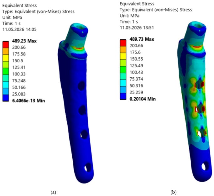 Finite-element equivalent stress maps of a femoral stem under rigid and elastic fixation assumptions