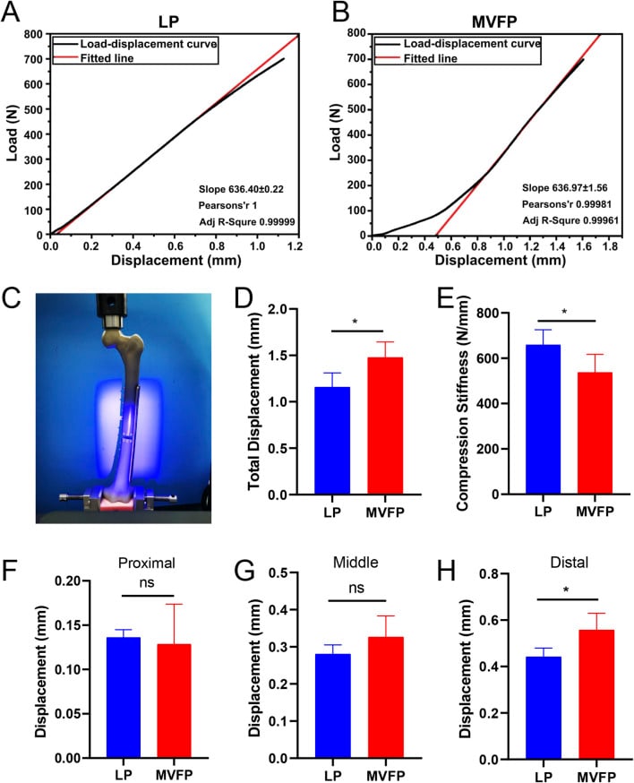 Femoral fixation constructs with vertical load-displacement curves, stiffness and interfragmentary displacement results