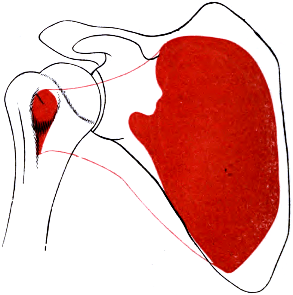 Line diagram of the right scapula and proximal humerus with the subscapularis shaded red over the subscapular fossa origin and the lesser tuberosity insertion.