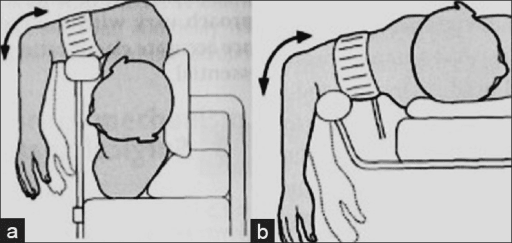 Illustration showing lateral and prone positioning options for distal humerus and posterior elbow surgery