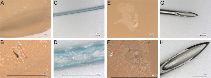 Microscopic panels showing surgical glove tears from abrasive suture and punctures from a cannula.
