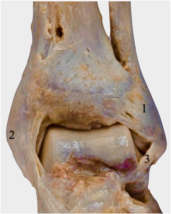 Cadaveric anterior and posterior views of the ankle with the anterior and posterior inferior tibiofibular, deltoid, talofibular and intermalleolar ligaments numbered