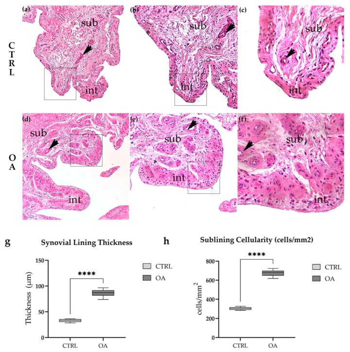 Histology of control and osteoarthritic synovial tissue showing intimal and subintimal changes