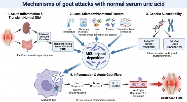 Schematic diagram of the mechanisms triggering acute gouty arthritis flares