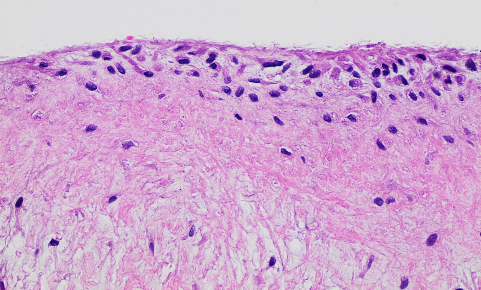 H&E histology of normal synovial membrane.