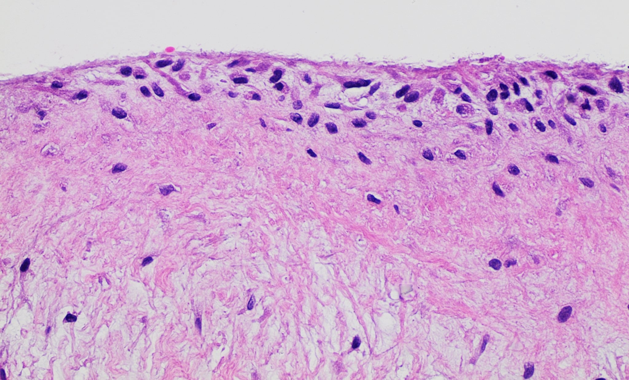 H&E histology of normal synovial membrane.
