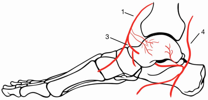 Schematic of the arterial blood supply entering the talar neck and body from anterior tibial, posterior tibial and medial talar branches