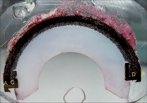 Sectioned and stained retrieved tantalum acetabular cup prepared for histological analysis.