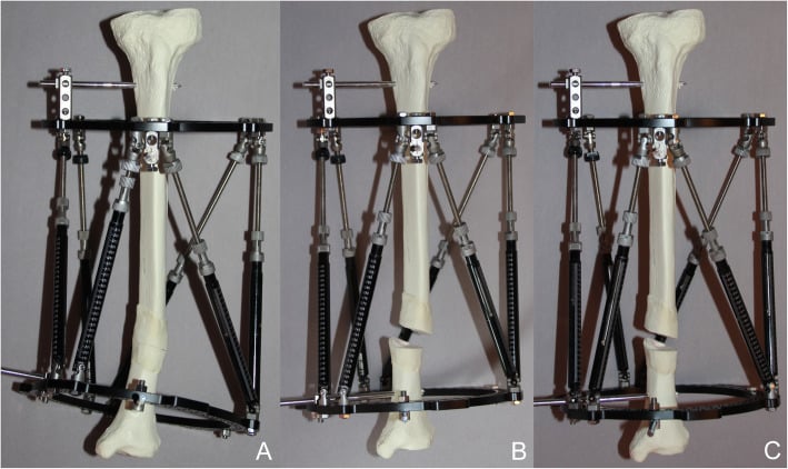 Sawbone tibia model in a hexapod frame, panels A-C, showing residual translation after correction from an uncalibrated frame-offset measurement and restored alignment after calibrated measurement.