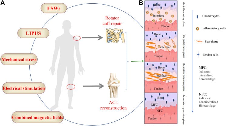 Diagram of external physical stimulation methods and cellular progression through four stages of tendon-bone interface healing