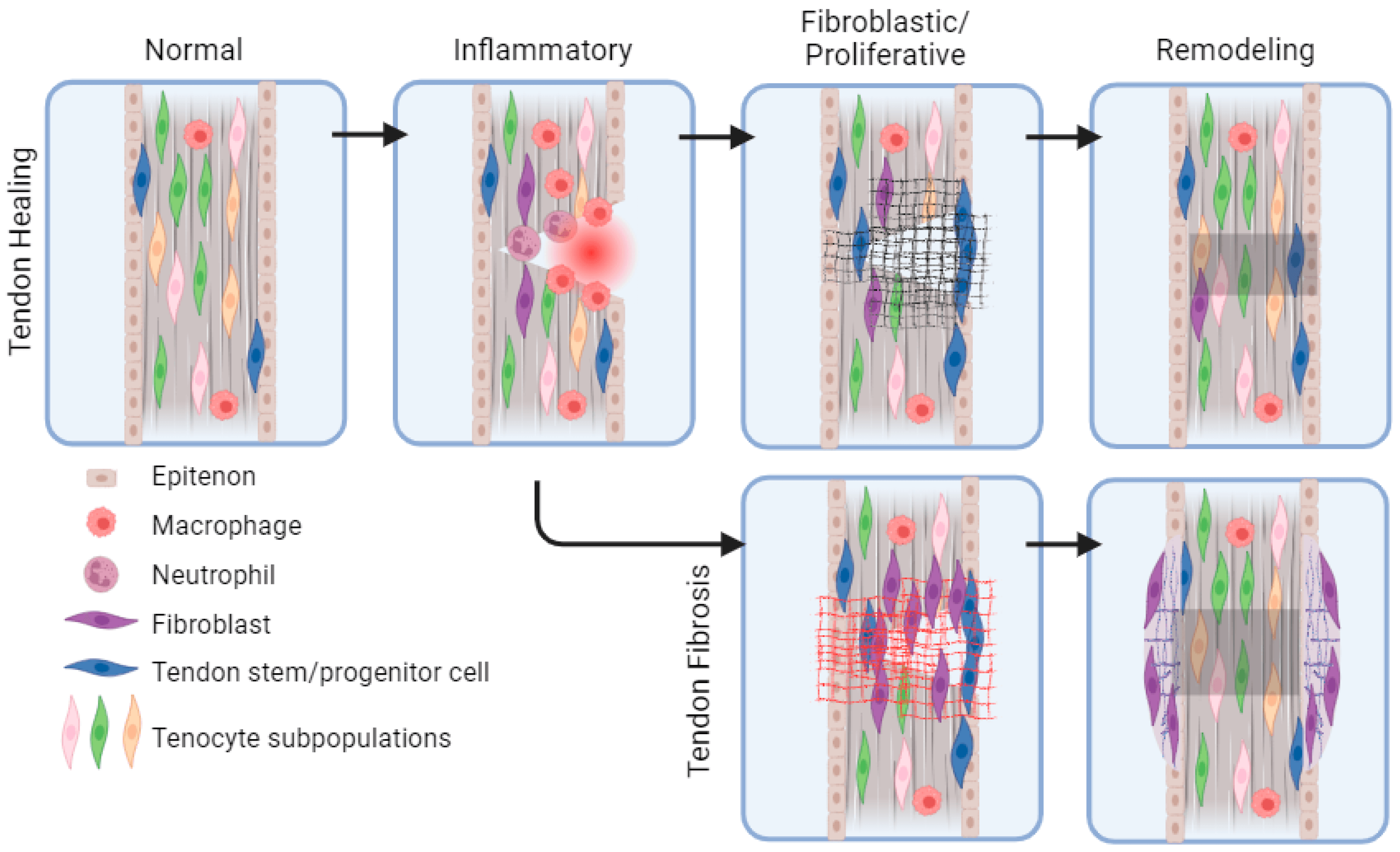 Schematic of the stages of tendon healing (normal, inflammatory, fibroblastic/proliferative, remodeling) and the alternative fibrosis pathway, with the cell types involved.