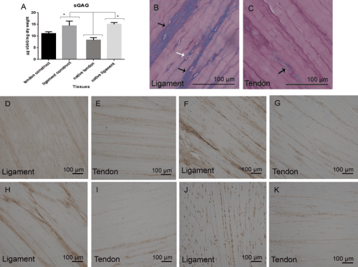 Multi-panel research figure comparing sulfated glycosaminoglycan (sGAG) content and matrix histology of native tendon, native ligament and tissue-engineered constructs: a bar chart of sGAG content (micrograms per milligram dry weight), Alcian blue-periodic acid Schiff histology, and immunohistochemistry panels labelled Ligament and Tendon with 100 micrometre scale bars.