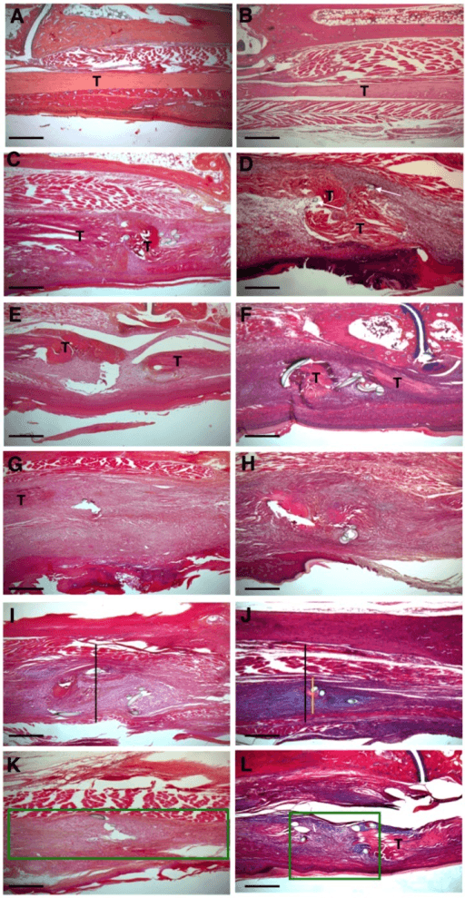 Twelve-panel haematoxylin and eosin histology of healing flexor digitorum longus (FDL) tendons in wild-type versus Mmp9 knockout mice: sham controls and repaired tendons at successive time points, with the tendon marked T and bracket/box annotations highlighting the area of remodelling around the repair site.