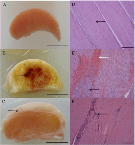 Six-panel figure of normal and injured equine superficial digital flexor tendon (SDFT): cross-sectional macroscopic photographs of a normal tendon, a sub-acutely injured tendon with a discoloured central core lesion and haemorrhage, and a chronically injured tendon, alongside corresponding haematoxylin and eosin histology with arrows marking the lesion.