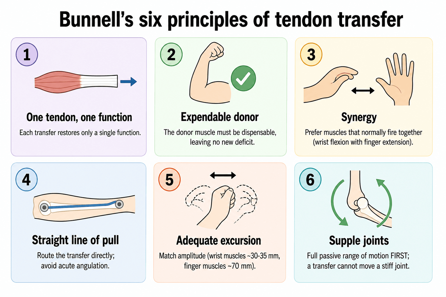 Infographic of Bunnell's six principles of tendon transfer: one tendon one function, expendable donor, synergy, straight line of pull, adequate excursion, supple joints