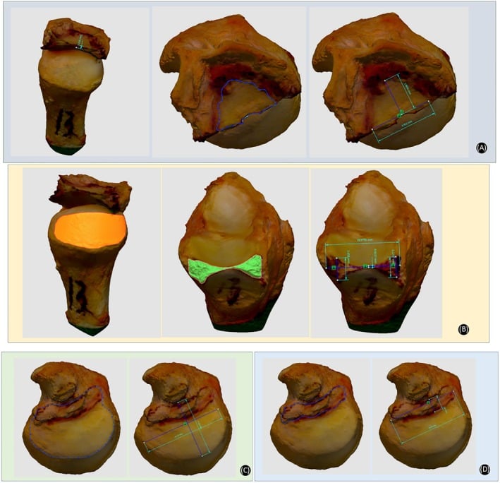 Three-dimensional specimen models in four panels (A-D) showing the central disc, sigmoid notch, ulnar head and ligament footprints outlined or highlighted as separate measured surfaces