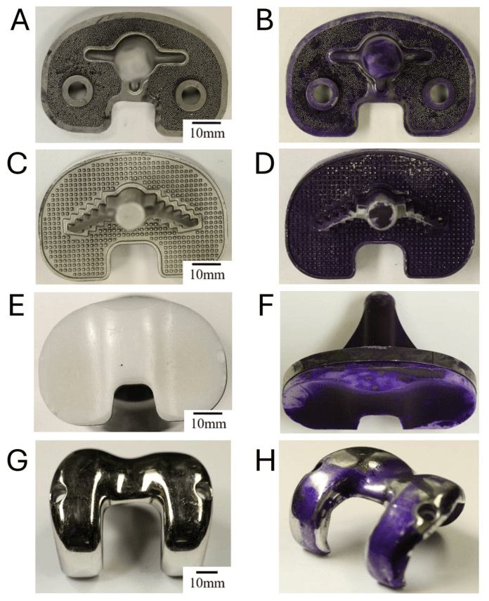 Knee arthroplasty components, panels A-H, shown unstained in the left column and after crystal-violet staining of a Staphylococcus epidermidis biofilm in the right column
