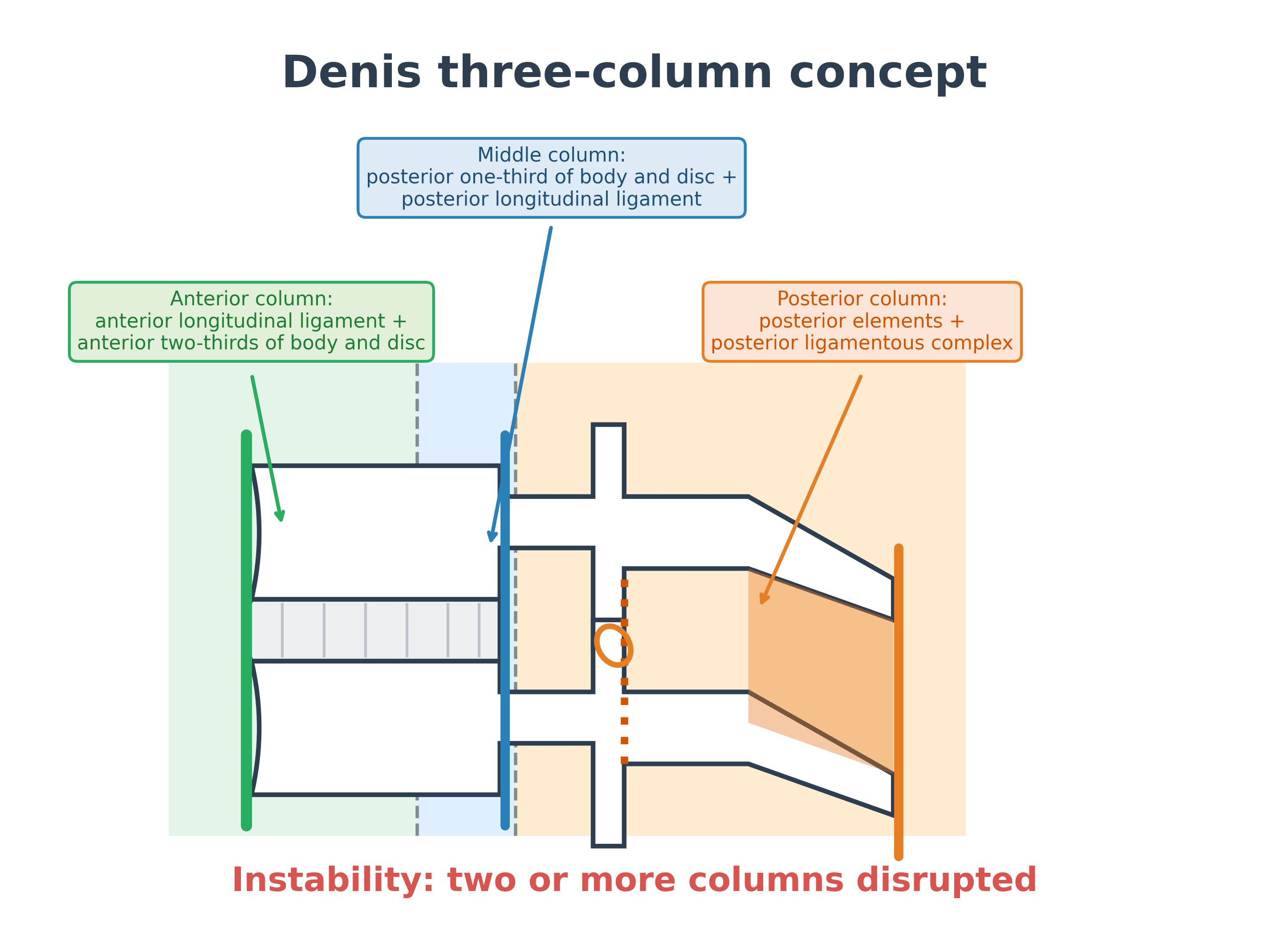 Denis three-column concept diagram