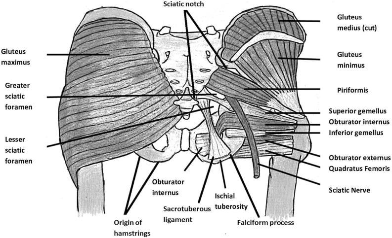 Anatomical schematic of the subgluteal region showing the course of the sciatic nerve