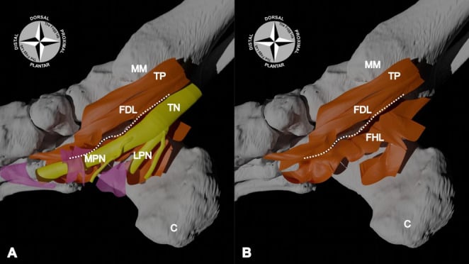 Digital 3D model of tarsal tunnel contents showing the tibial nerve and flexor tendons