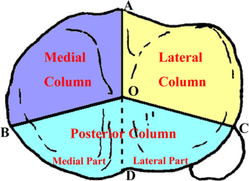 Diagram of the three-column classification of the tibial plateau
