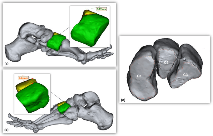 Three-dimensional cuneiform geometry and distal articular surfaces