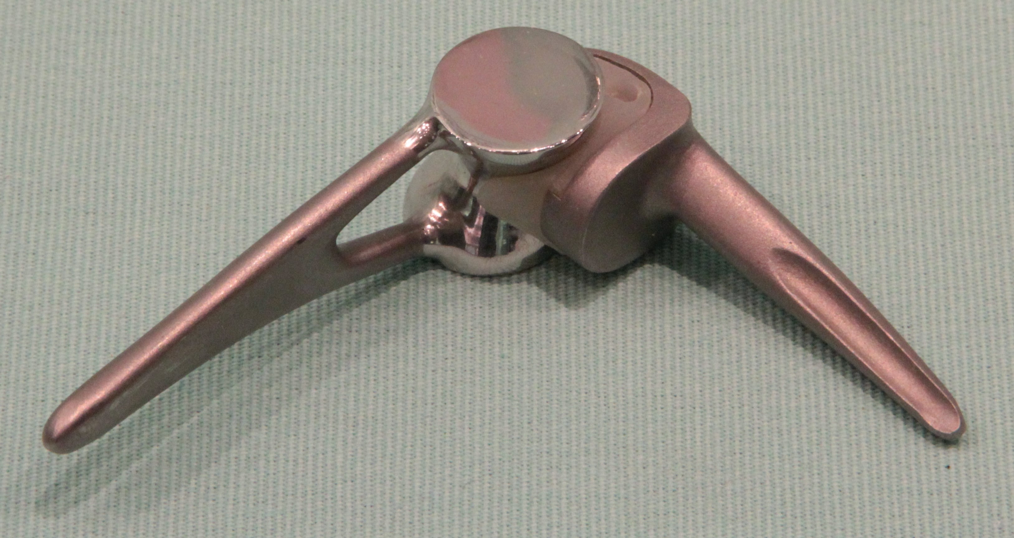 A linked (semi-constrained) total elbow prosthesis.
