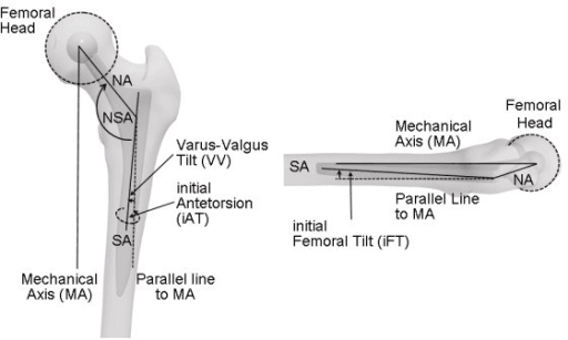 Coronal and sagittal geometric model of femoral stem orientation with neck-shaft angle