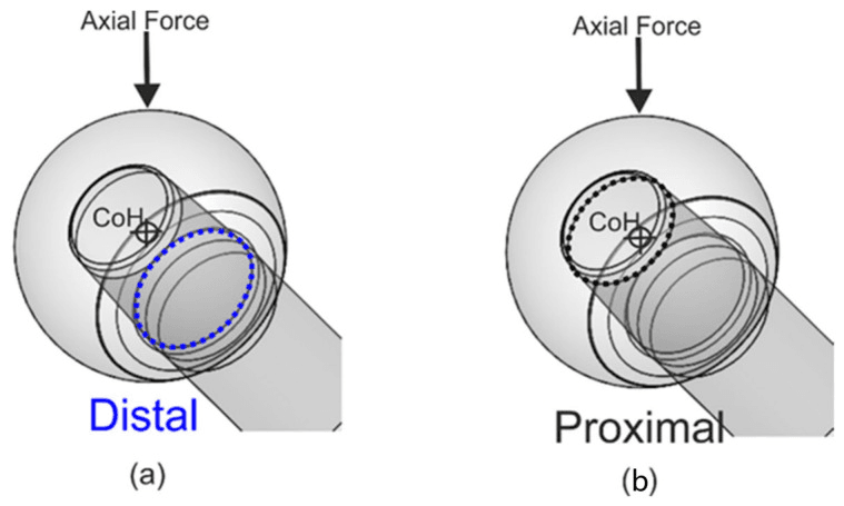 Distal and proximal taper engagement relative to the centre of the head under an axial force
