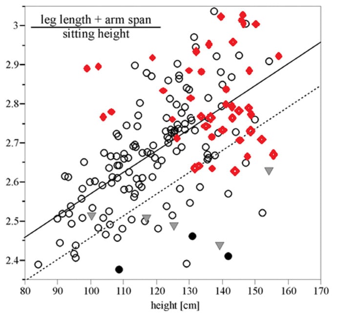 Plot of extremity-to-trunk ratio against height in patients with Turner syndrome