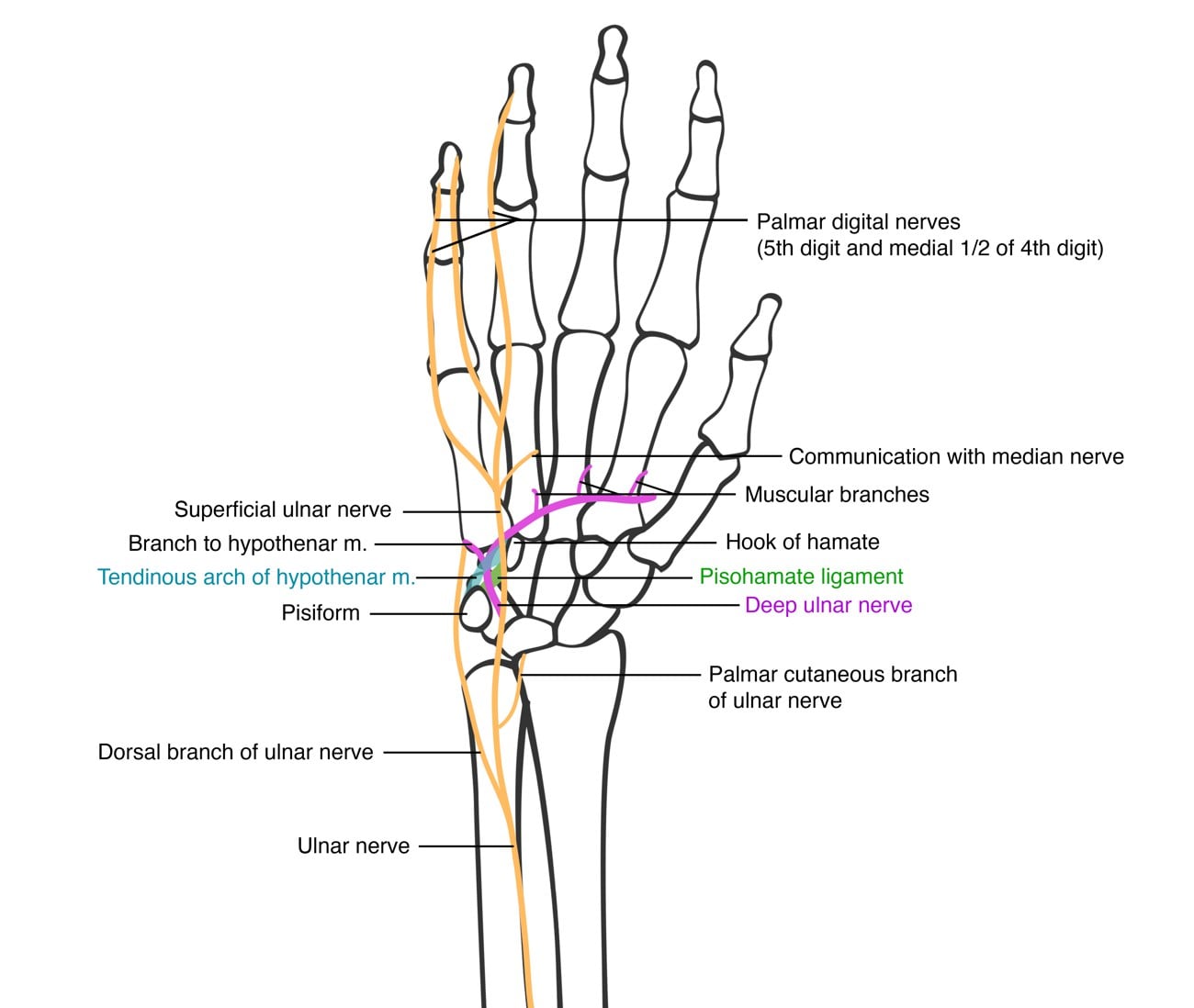 Labelled anatomical diagram of the ulnar nerve branches in the hand — superficial and deep branches, dorsal and palmar cutaneous branches, Guyon's canal landmarks.
