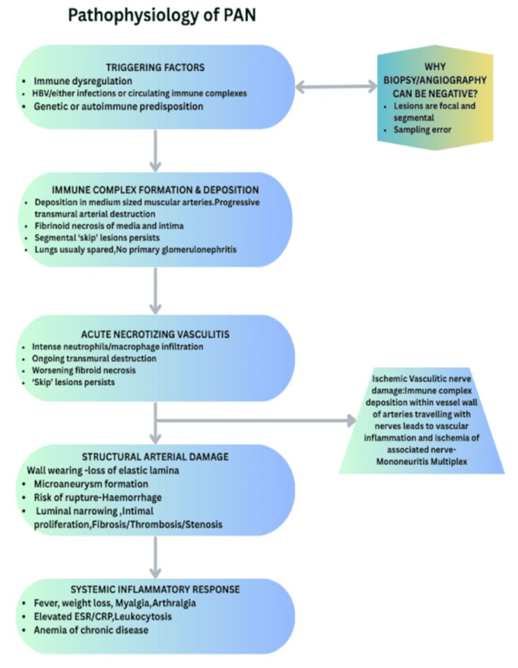 Pathophysiology schematic diagram of Polyarteritis Nodosa (PAN) mechanisms