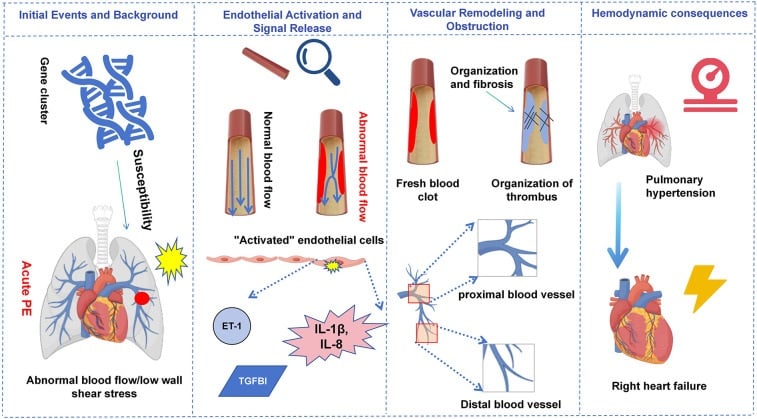 Diagram of chronic thromboembolic pulmonary hypertension pathophysiology