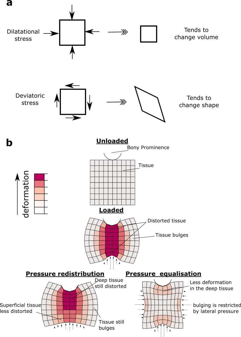 Mechanical diagrams comparing deep-tissue deformation, pressure redistribution and pressure equalisation