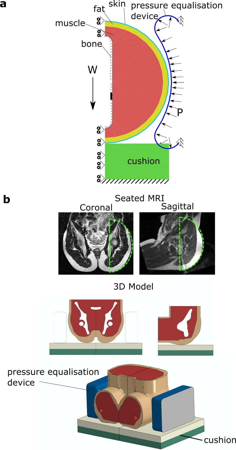 Finite-element model of seated ischial tissue, cushion and lateral pressure-equalisation device