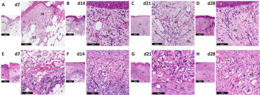 Eight H and E histology panels of a healing skin wound at days 7, 14, 21 and 28