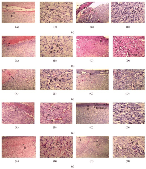 Grid of H and E stained histology panels of granulation tissue from days 8 and 12 of wound healing