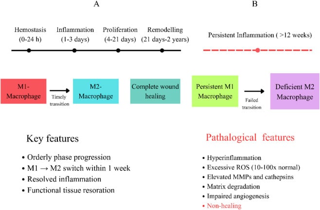 Diagram comparing the phases of normal wound healing with chronic wound pathophysiology and macrophage dysfunction