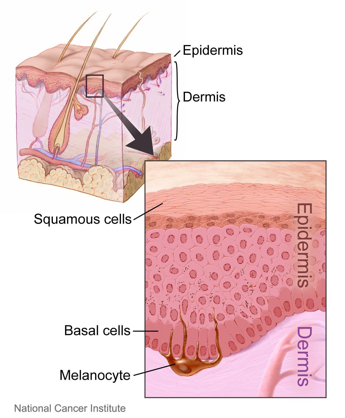 Illustration of the layers of the skin with a close-up of epidermal cell types